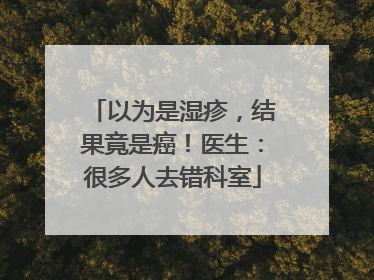 以为是湿疹,结果竟是癌!医生:很多人去错科室